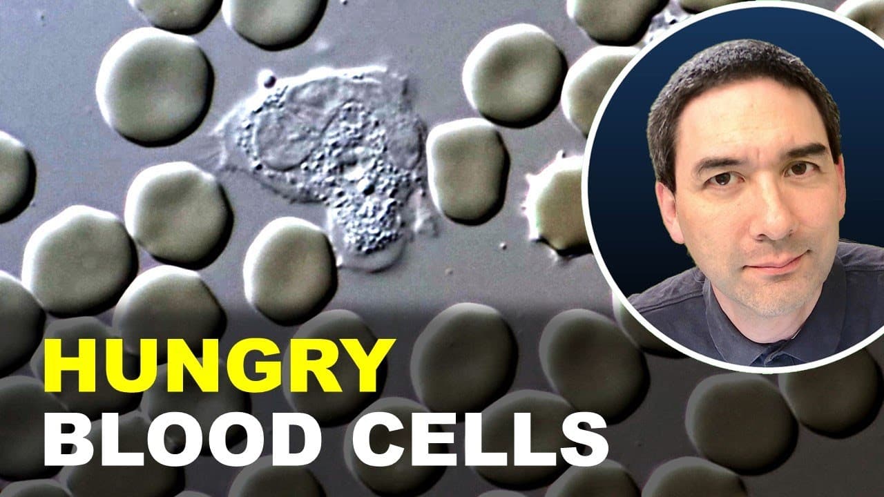 White Blood Cells Attacking Bacteria Under the Microscope